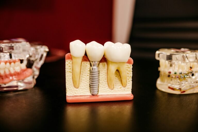 Implante dentare