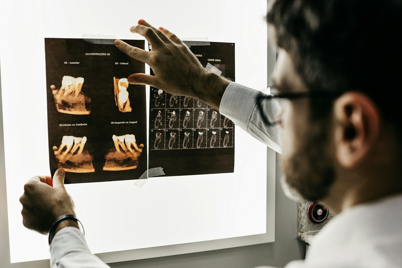 Analizë e radiografisë dentare